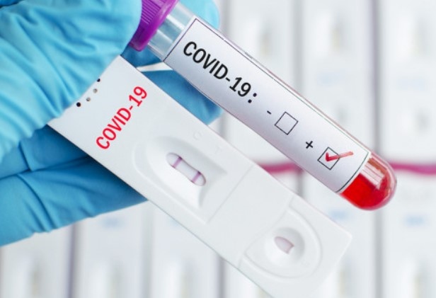 162 са новите случаи но коронавирус в България сочат данните